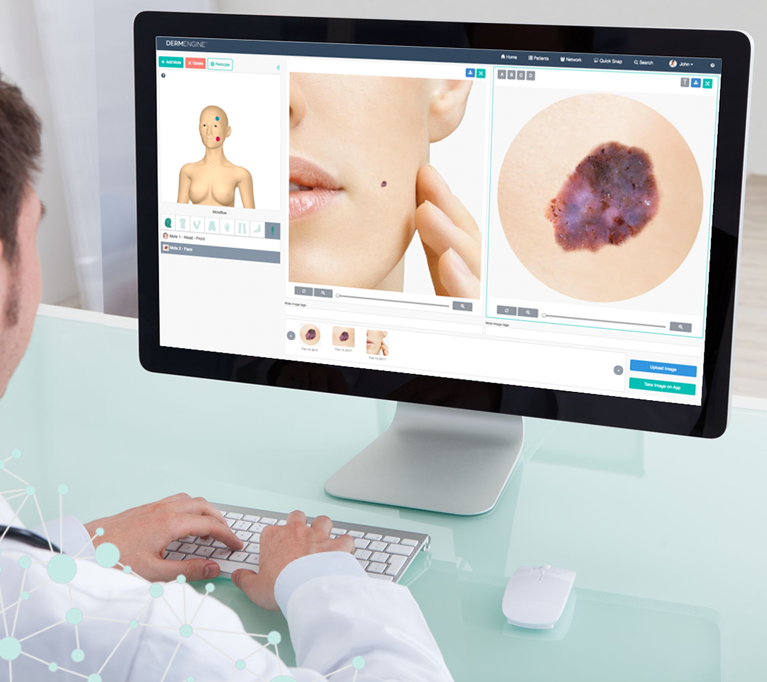 dermengine evolution tracker doctor
